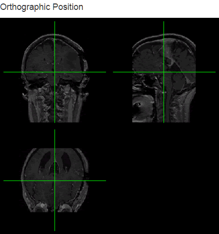 orthographic